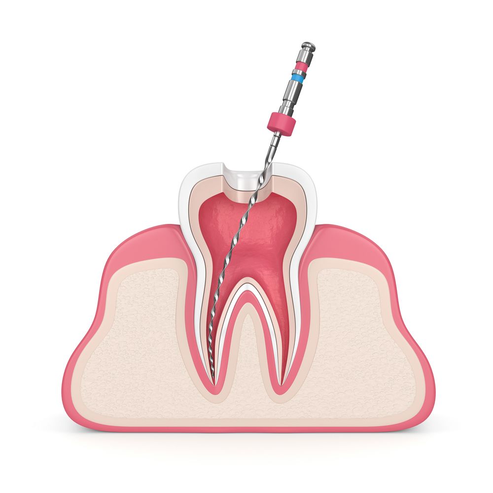 endodoncja